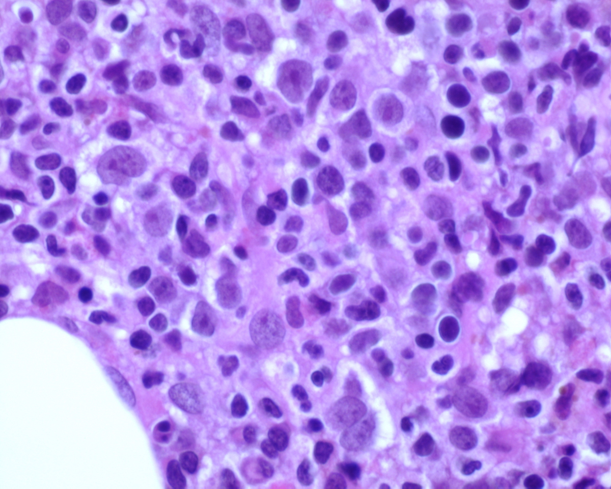 Core BX high power 60X